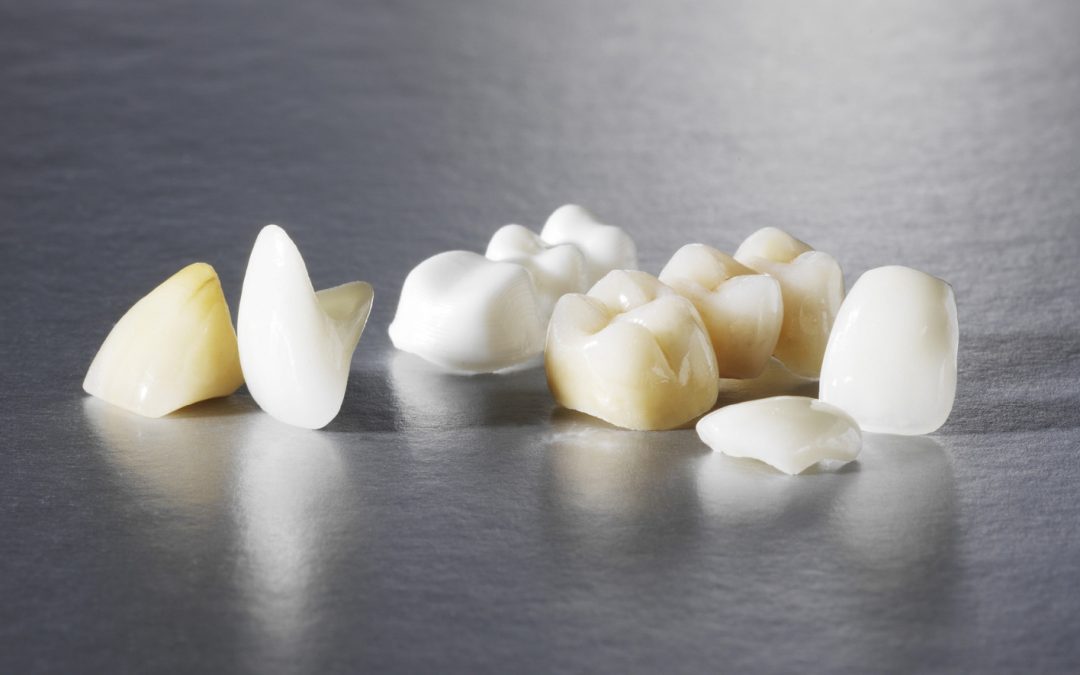 Коронка на зуб — технология изготовления, виды и результаты протезирования